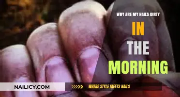 Why Do My Nails Look Dirty in the Morning? Explained