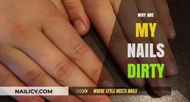 Why Are My Nails Dirty? Causes, Prevention, and Quick Fixes
