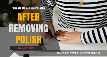 Nail Discoloration: Post-Polish Yellowing and How to Prevent It