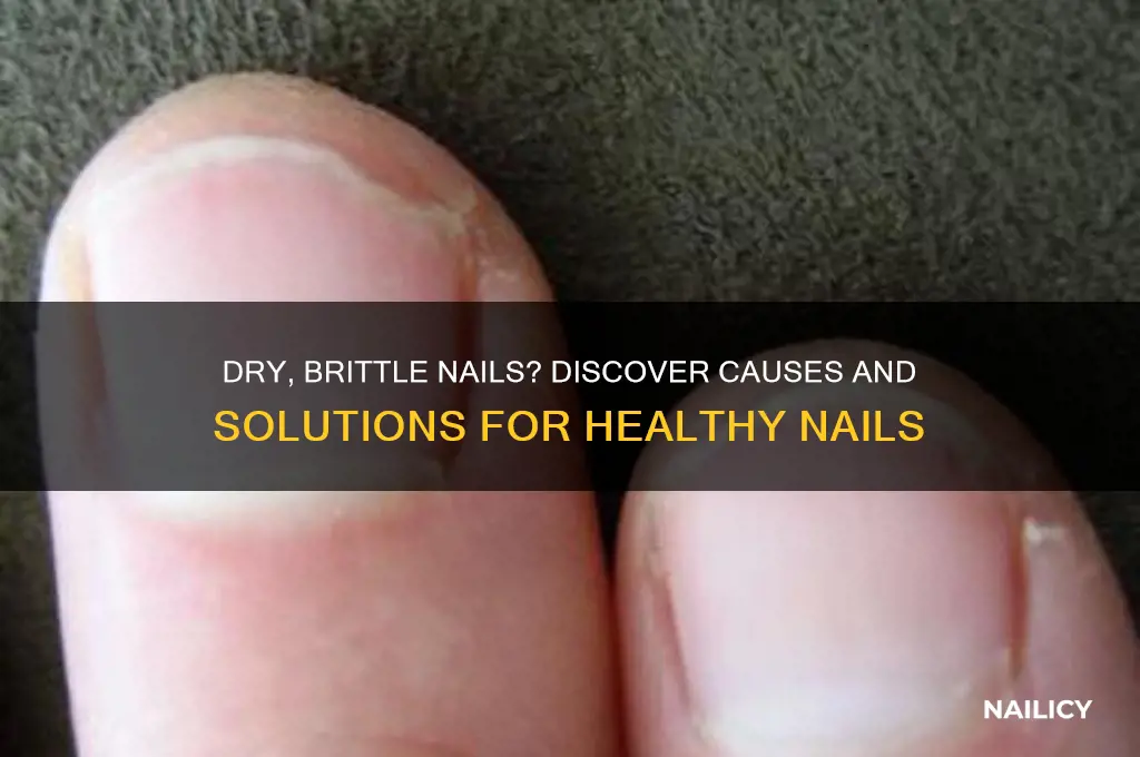 why are my nails dry and brittle