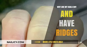 Dry, Ridged Nails: Causes, Solutions, and Healthy Nail Care Tips