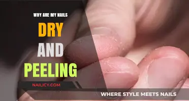 Dry and Peeling Nails: Causes, Solutions, and Prevention Tips