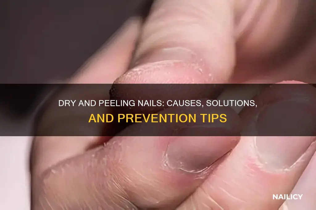 why are my nails dry and peeling