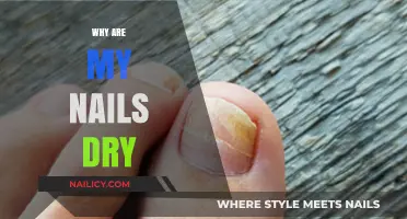 Dry Nails? Discover Causes and Solutions for Healthy, Hydrated Cuticles