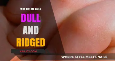 Dull and Ridged Nails: Causes, Solutions, and Healthy Nail Care Tips