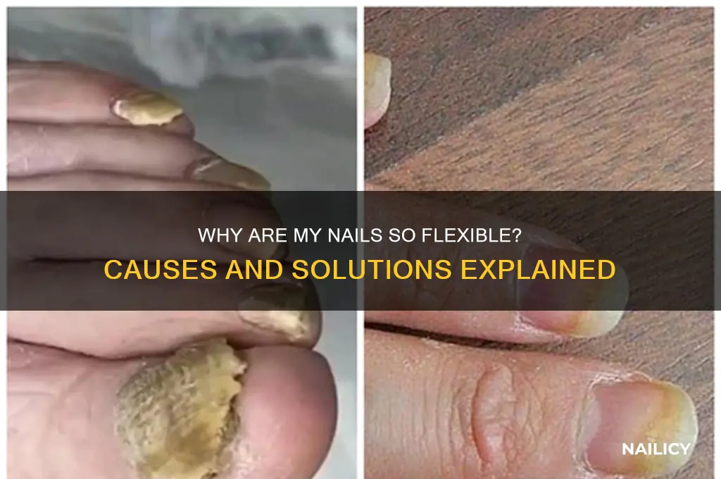 why are my nails easy to bend