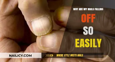 Why Are My Nails Falling Off Easily? Causes and Solutions