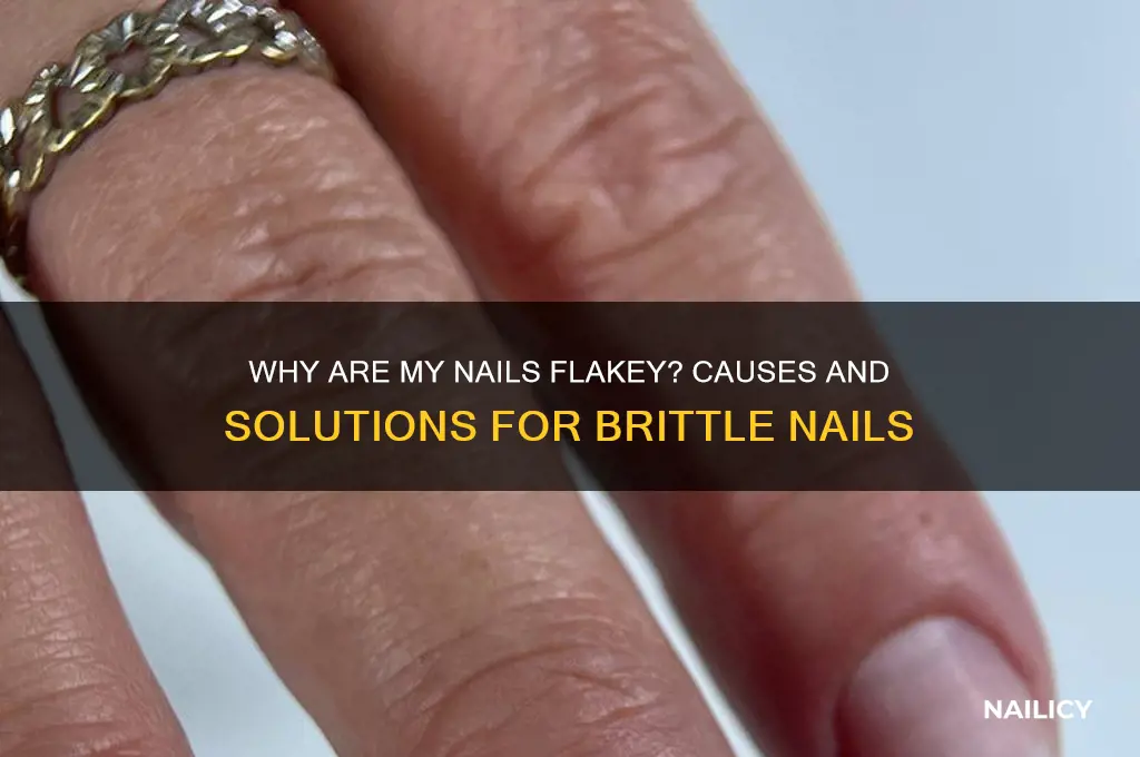 why are my nails flakey