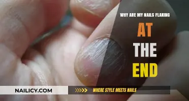 Why Are My Nails Flaking at the End? Causes and Solutions