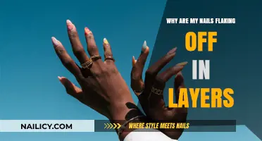 Why Are My Nails Flaking Off in Layers? Causes and Solutions