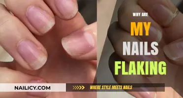 Why Are My Nails Flaking? Causes, Solutions, and Prevention Tips