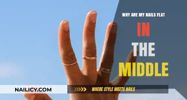 Flat Nails in the Middle? Causes and Solutions Explained