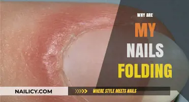 Why Are My Nails Folding? Causes, Prevention, and Treatment Solutions