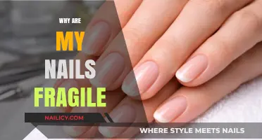 Why Are My Nails Fragile? Causes and Solutions for Brittle Nails