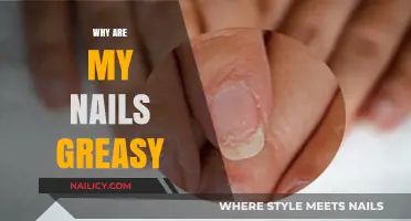 Greasy Nails? Uncover the Surprising Causes and Solutions for Shiny Nails