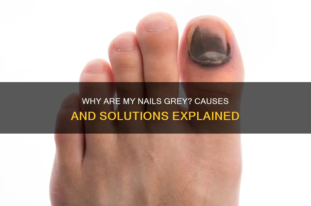 why are my nails grey