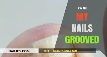 Grooved Nails: Causes, Concerns, and Solutions for Healthy Nail Care