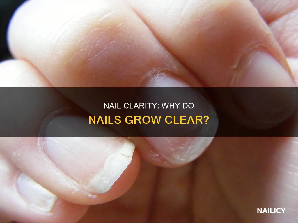 why are my nails growing clear