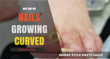 Curved Nails: Why Does It Happen?