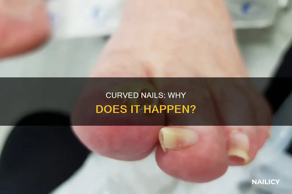 why are my nails growing curved