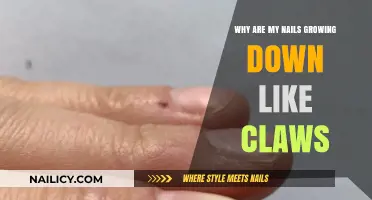 How to Stop Nails Growing Down Like Claws