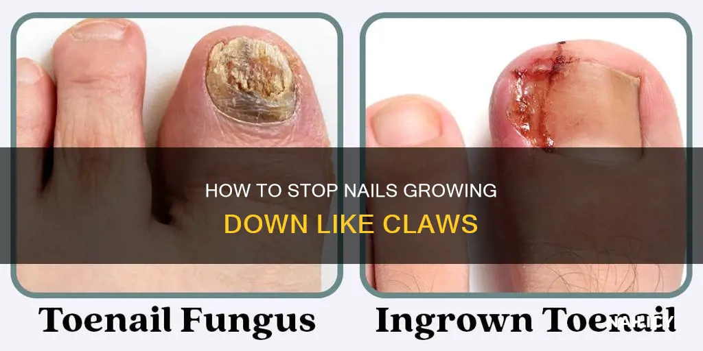 why are my nails growing down like claws