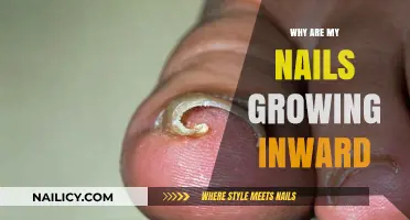 How to Stop Nails Growing Inward