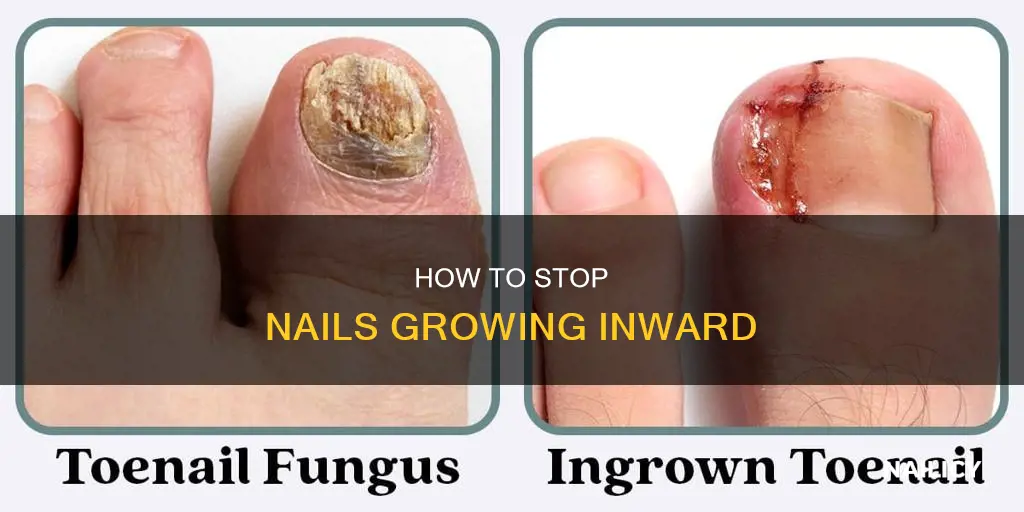 why are my nails growing inward