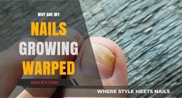 Nail Growth: Warped Nails and Their Causes
