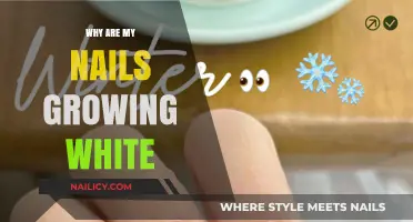 Nail Health: Why Are My Nails Growing White?