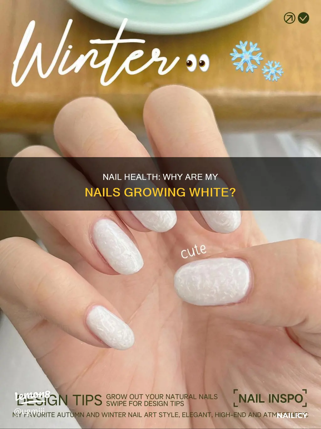 why are my nails growing white