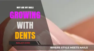 Nail Dents: Understanding the Cause of Your Nail Growth Issues
