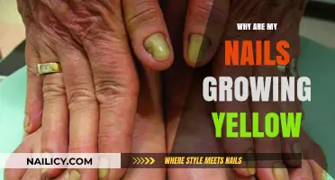 Yellow Nails: Causes and Prevention