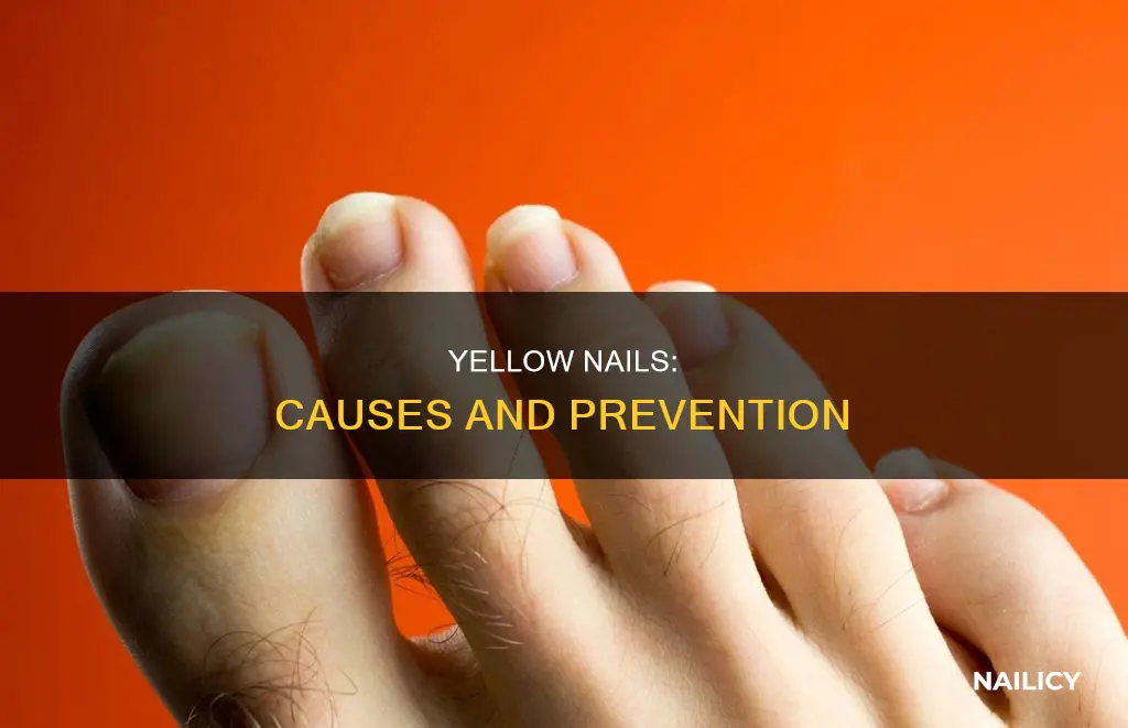 why are my nails growing yellow