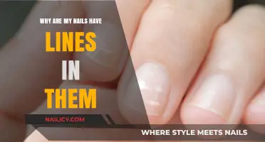 Understanding Vertical Lines on Nails: Causes and Solutions Explained
