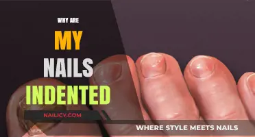 Indented Nails: Causes, Concerns, and Solutions for Healthy Nail Care