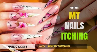 Why Are My Nails Itching? Causes, Remedies, and Prevention Tips