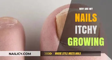 Itchy Nails: Why Do They Grow This Way?