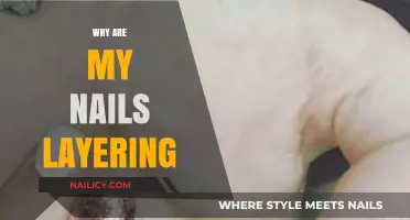Why Are My Nails Layering? Causes, Prevention, and Solutions Explained