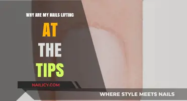 Why Are My Nails Lifting at the Tips? Causes and Fixes