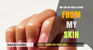 Why Are My Nails Lifting? Causes, Prevention, and Solutions
