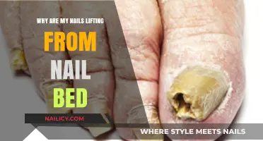 Nail Lifting Explained: Causes and Solutions for Healthy Nails