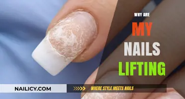 Why Are My Nails Lifting? Causes and Solutions Explained