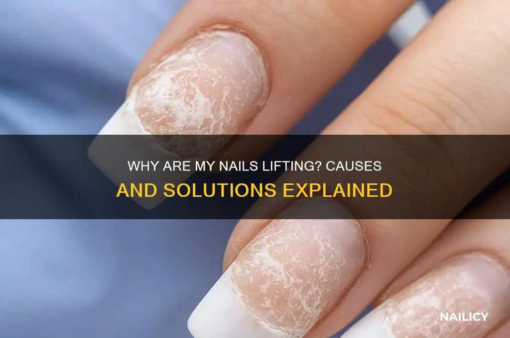 why are my nails lifting