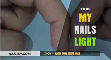 Why Are My Nails Light? Causes and Solutions Explained