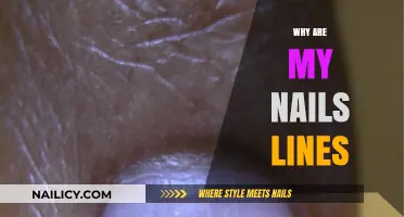 Understanding Nail Lines: Causes, Concerns, and When to Seek Help