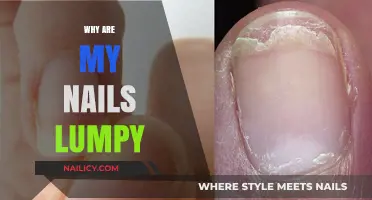 Why Are My Nails Lumpy? Causes, Concerns, and Solutions Explained