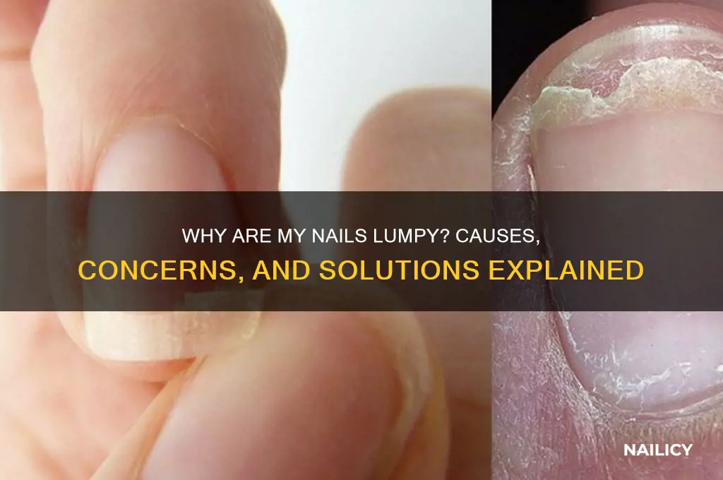why are my nails lumpy