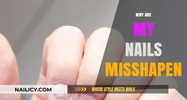 Understanding Misshapen Nails: Causes, Concerns, and Effective Solutions