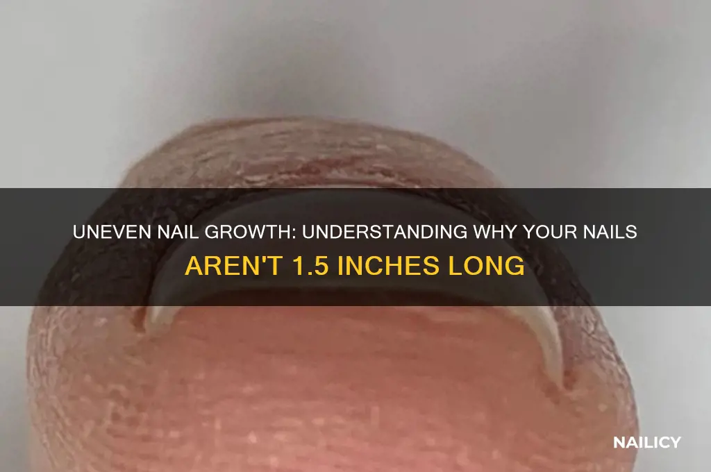 why are my nails not 1 1 2